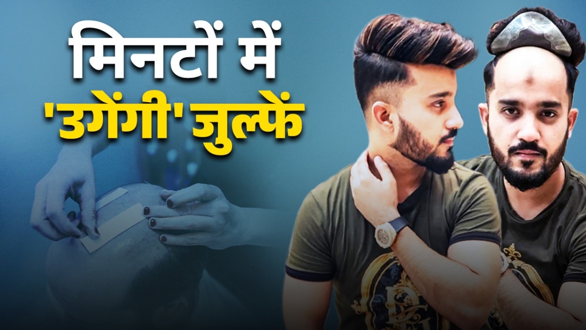 हेयर विग की दुनिया: इतिहास, निर्माण, सुरक्षा और बहुत कुछ