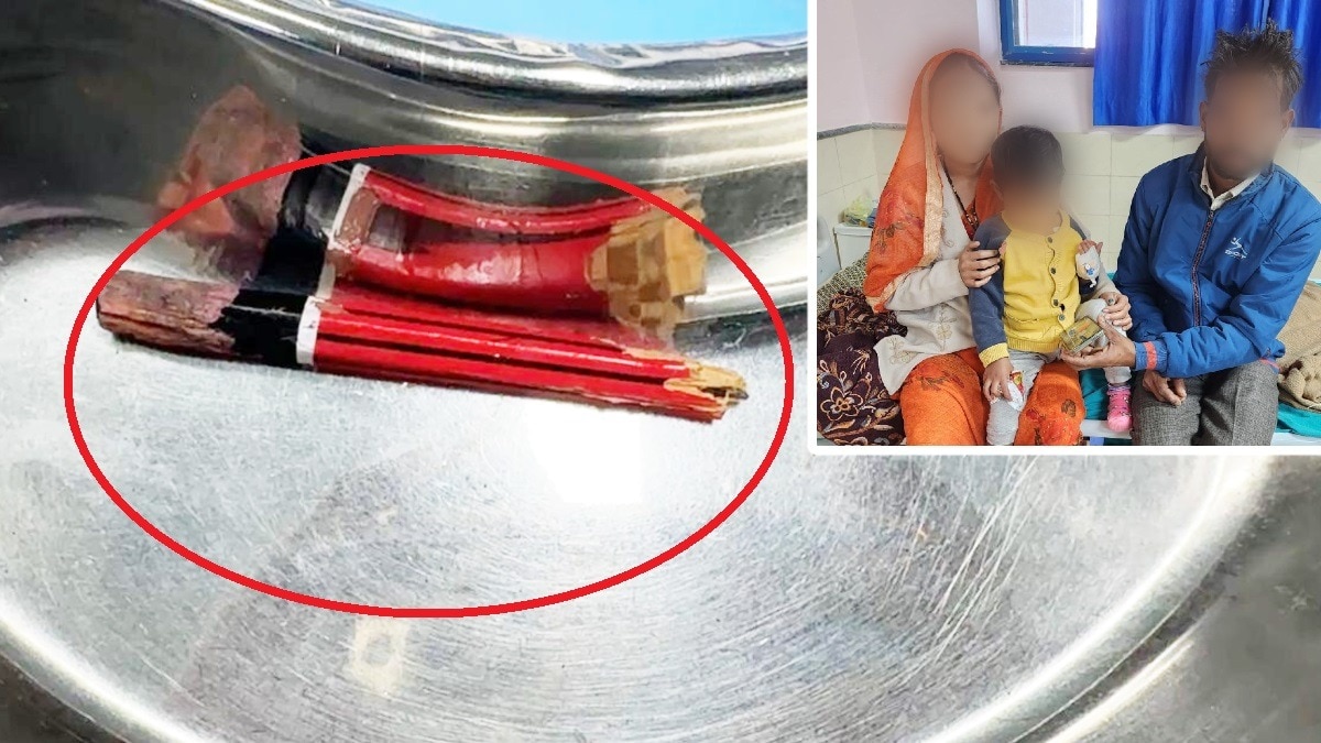 एम्स भोपाल में चमत्कार: मस्तिष्क तक पहुँची पेंसिल निकालकर बच्ची की जान बचाई